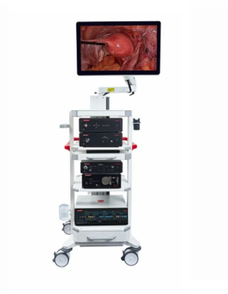 Endoscopie et chirurgie mini-invasive