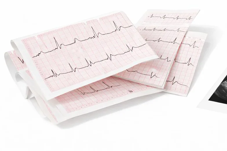 Papier ECG thermique